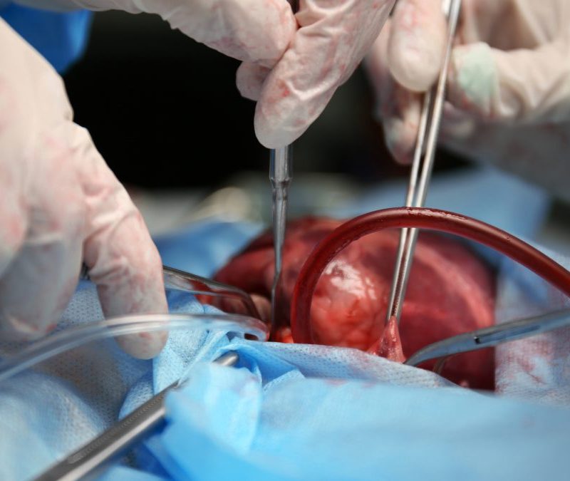 Curso de Trasplante para Médicos ANBA